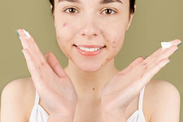 Hydration Heroes: Top Moisturizing Creams for Soothing Dry Facial Skin
